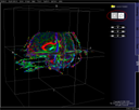 Tractography View