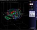 Tractography View